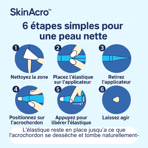 SkinAcro™ – Kit d’élimination des acrochordons (40 traitements)